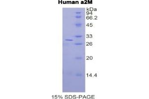 SDS-PAGE of Protein Standard from the Kit (Highly purified E.