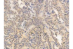 ABIN6263785 and ABIN6266653 at 1/100 staining human pituitary adenoma by IHC-P. (NUB1 antibody  (C-Term))