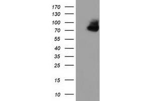 HEK293T cells were transfected with the pCMV6-ENTRY control (Left lane) or pCMV6-ENTRY OSBPL11 (Right lane) cDNA for 48 hrs and lysed. (OSBPL11 antibody)