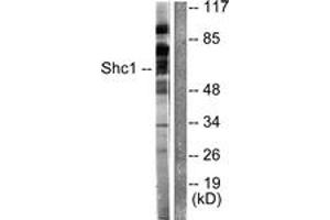 Western blot analysis of extracts from HeLa cells, treated with Calyculin A 50nM 15', using Shc (Ab-349) Antibody.