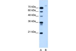 Western Blotting (WB) image for anti-Ubiquitin Specific Peptidase 48 (USP48) antibody (ABIN2463984) (USP48 antibody)