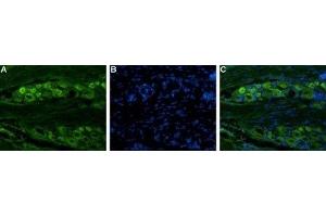 Expression of NaV1. (Nav1.8 antibody  (C-Term, Intracellular))