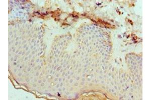 Immunohistochemistry of paraffin-embedded human skin tissue using ABIN7151879 at dilution of 1:100 (Ephrin B2 antibody  (AA 28-229))