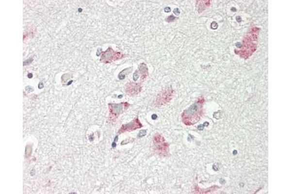 PCDHA3 antibody  (AA 773-800)