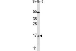 Western Blotting (WB) image for anti-NOTCH-Regulated Ankyrin Repeat Protein (NRARP) antibody (ABIN2997445) (NRARP antibody)