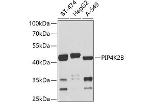 Western blot analysis of extracts of various cell lines, using PIP4K2B antibody (ABIN6130647, ABIN6145676, ABIN6145679 and ABIN6224039) at 1:1000 dilution. (PIP4K2B antibody  (AA 1-270))