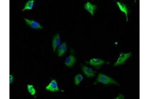 Immunofluorescence staining of U251 cells with ABIN7143354 at 1:100, counter-stained with DAPI. (CAP1 antibody  (AA 22-157))