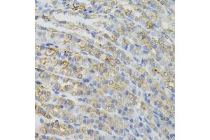 Immunohistochemistry of paraffin-embedded mouse stomach using CBL antibody (ABIN5995395) (40x lens). (CBL antibody)
