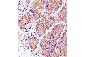 Immunohistochemical analysis of paraffin-embedded H. (PINK1 antibody)