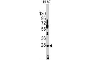 Western blot analysis of HES1 polyclonal antibody  in HL-60 cell lysate (35 ug/lane). (HES1 antibody  (N-Term))