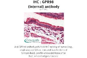 Image no. 1 for anti-G Protein-Coupled Receptor 98 (Gpr98) (Internal Region) antibody (ABIN1735202) (Gpr98 antibody  (Internal Region))