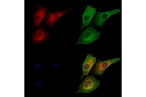 ABIN6260779 and ABIN6273207 staining HUVEC cells by IF/ICC. (CFHR3 antibody  (Internal Region))