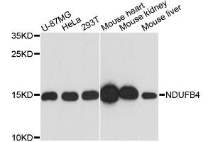 Western blot analysis of extracts of various cell lines, using NDUFB4 antibody. (NDUFB4 antibody)