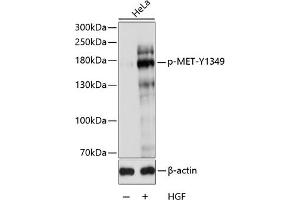 Western blot analysis of extracts of HeLa cells, using Phospho-MET-Y1349 antibody (ABIN3019529, ABIN3019530, ABIN3019531 and ABIN6225449) at 1:1000 dilution. (c-MET antibody  (pTyr1349))