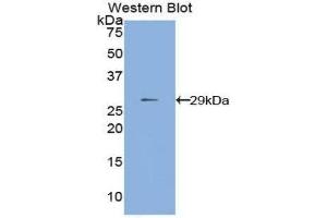 Western Blotting (WB) image for anti-Matrix Metallopeptidase 24 (Membrane-inserted) (MMP24) (AA 429-642) antibody (ABIN1859852) (MMP24 antibody  (AA 429-642))