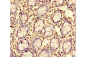 Immunohistochemistry of paraffin-embedded human colon tissue using ABIN7173015 at dilution of 1:100 (TMPRSS7 antibody  (Ser7))
