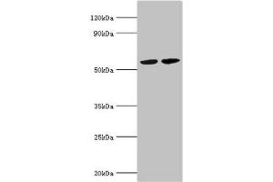 Western blot All lanes: A/G-specific adenine DNA glycosylase antibody at 5 μg/mL Lane 1: Hela whole cell lysate Lane 2: Jurakt whole cell lysate Secondary Goat polyclonal to rabbit IgG at 1/10000 dilution Predicted band size: 61, 60, 59, 58 kDa Observed band size: 61 kDa (MUTYH antibody  (AA 1-265))