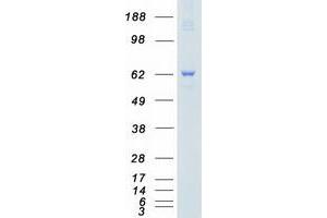 Validation with Western Blot (PAK4 Protein (Transcript Variant 2) (Myc-DYKDDDDK Tag))