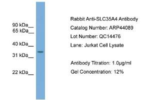 WB Suggested Anti-SLC35A4  Antibody Titration: 0. (SLC35A4 antibody  (Middle Region))