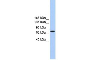 TMC2 antibody used at 1 ug/ml to detect target protein. (Tmc2 antibody  (Middle Region))