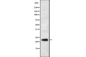 Western blot analysis IL17C using HT29 whole cell lysates (IL17C antibody  (Internal Region))