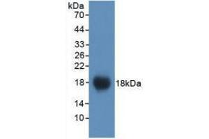 Western blot analysis of recombinant Mouse VCAM1. (VCAM1 antibody  (AA 511-682))