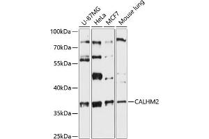 Western blot analysis of extracts of various cell lines, using C antibody (ABIN6131487, ABIN6137870, ABIN6137871 and ABIN6216831) at 1:3000 dilution. (CALHM2 antibody  (AA 1-323))