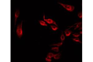 ABIN6274888 staining HT29 by IF/ICC. (DDX19B antibody  (N-Term))