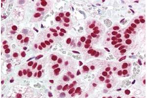 Human Adrenal (formalin-fixed, paraffin-embedded) stained with ACIN1 antibody ABIN461881 at 5 ug/ml followed by biotinylated goat anti-rabbit IgG secondary antibody ABIN481713, alkaline phosphatase-streptavidin and chromogen.