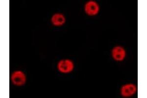 ABIN6278635 staining HepG2 by IF/ICC. (Sp2 antibody  (C-Term))