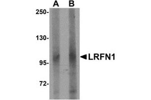 Western Blotting (WB) image for anti-Leucine Rich Repeat and Fibronectin Type III Domain Containing 1 (LRFN1) (C-Term) antibody (ABIN1030489) (LRFN1 antibody  (C-Term))
