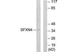 Western blot analysis of extracts from HuvEc cells, using SFXN4 Antibody. (Sideroflexin 4 antibody  (AA 1-50))