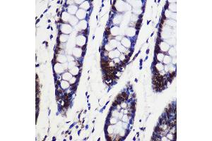 Immunohistochemistry of paraffin-embedded Human colon using SARNP Rabbit pAb (ABIN6130106, ABIN6147381, ABIN6147382 and ABIN6217793) at dilution of 1:100 (40x lens). (SARNP antibody  (AA 1-210))
