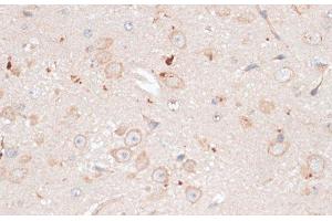 Immunohistochemistry (Paraffin-embedded Sections) (IHC (p)) image for anti-ATP-Binding Cassette, Sub-Family B (MDR/TAP), Member 7 (ABCB7) antibody (ABIN7258052)