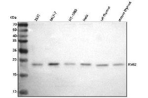 Western blot analysis of C16orf75/RMI2 using anti-C16orf75/RMI2 antibody (ABIN7600730).