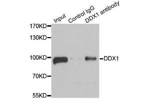 Immunoprecipitation analysis of 100ug extracts of 293T cells using 3ug DDX1 antibody. (DDX1 antibody  (AA 441-740))