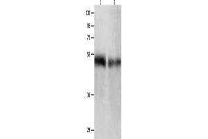 Gel: 10 % SDS-PAGE, Lysate: 50 μg, Lane 1-2: Human tongue tissue, Human laryngocarcinoma tissue, Primary antibody: ABIN7190003(BPIFB1 Antibody) at dilution 1/500, Secondary antibody: Goat anti rabbit IgG at 1/8000 dilution, Exposure time: 1 minute (BPIFB1 antibody)
