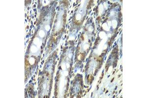 Immunohistochemistry of paraffin-embedded rat Intestine using Septin 7 antibody (ABIN1682655, ABIN3018092, ABIN3018093 and ABIN6220357) at dilution of 1:100 (40x lens). (7-Sep (AA 307-436) antibody)