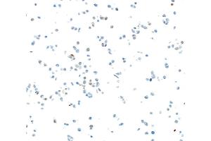 Immunocytochemistry (ICC) image for anti-SRY (Sex Determining Region Y)-Box 2 (SOX2) antibody (ABIN7449421) (SOX2 antibody)