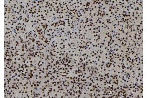 ABIN6273123 at 1/100 staining Mouse kidney tissue by IHC-P.
