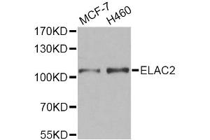 Western blot analysis of extracts of various cell lines, using ELAC2 Antibody. (ELAC2 antibody)