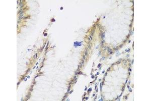 Immunohistochemistry of paraffin-embedded Human stomach using NAA50 Polyclonal Antibody at dilution of 1:200 (40x lens).