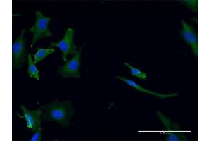 Immunofluorescence of monoclonal antibody to GPT2 on HeLa cell. (GPT2 antibody  (AA 358-456))