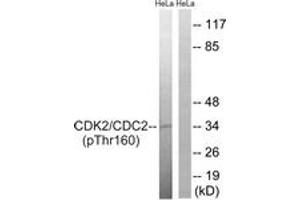 Western blot analysis of extracts from HeLa cells, using CDC2 (Phospho-Thr161) Antibody. (CDK1 antibody  (pThr161))