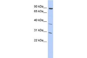 WB Suggested Anti-KLHL5 Antibody Titration:  0. (KLHL5 antibody  (Middle Region))