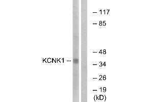 Western blot analysis of extracts from Jurkat cells, using KCNK1 antibody. (KCNK1 antibody  (Internal Region))