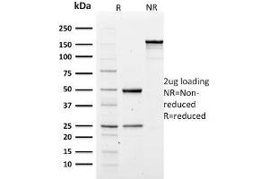 SDS-PAGE Analysis of Purified Spectrin alpha 1 Mouse Monoclonal Antibody (SPTA1/1810). (SPTA1 antibody  (AA 356-475))