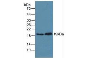 Figure. (MAPK14 antibody  (AA 19-279))