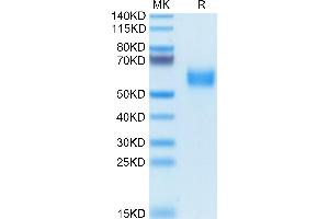 Biotinylated Human SIRP alpha V2/CD172a on Tris-Bis PAGE under reduced condition. (SIRP AlphaV2 (AA 31-369) protein (His-Avi Tag,Biotin))