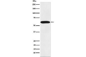 Western blot analysis of STIP1 expression in Jurkat cell lysate.